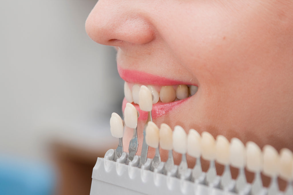 implante dental en guayaquil